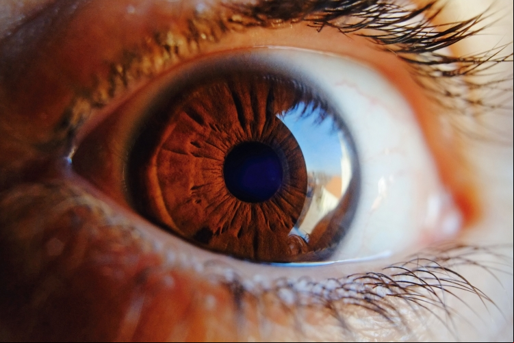 A retinopatia diabética surge, principalmente, em decorrência da extensão do período de convivência com o diabetes e da falta de controle dos níveis de glicose no sangue